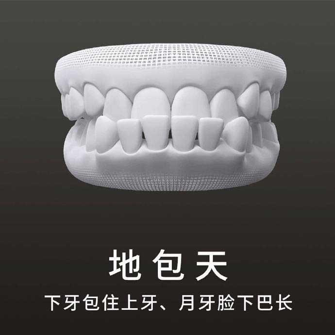 什么是地包天？地包天長什么樣子？地包天牙齒圖片
